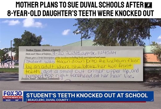 Mother plans to sue Duval Schools after 8-year-old daughter’s teeth were knocked out #ericjaystreetnews 🎥Action News Jax Part 2 | Eric Johnson