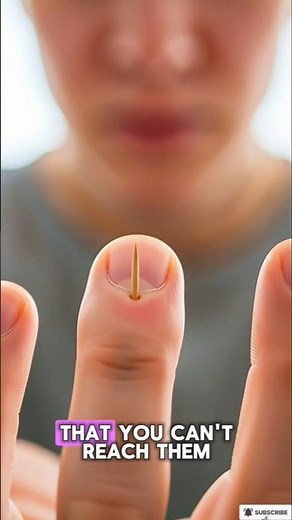 How splinters get unstuck😯