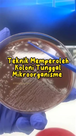 Pemurnian Mikroorganisme dengan Metode Streak Plate