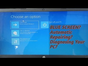How to Fix Automatic Repair Loop in Windows 10/11|How To FIX Startup Repair Couldn’t Repair Your PC