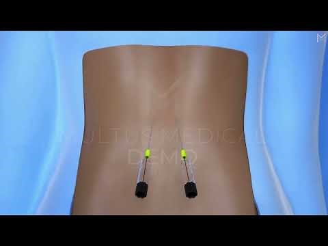 Spinal Cord Simulator Animation