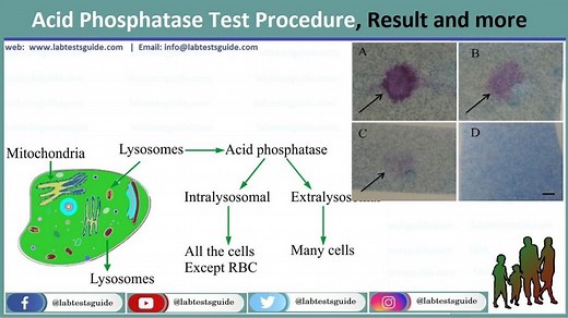 Acid Phosphatase Test Procedure | Lab Tests Guide