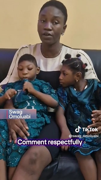 Microcephalic case . Swag omoluabi | microcephaly