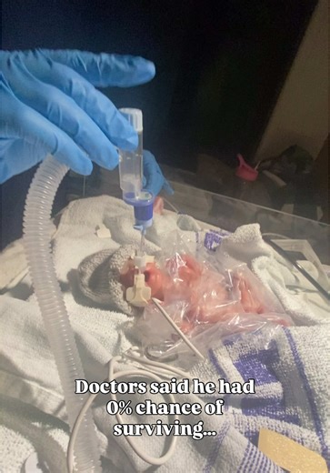 Harry's Inspiring Journey: A 22-Week Micropreemie Miracle