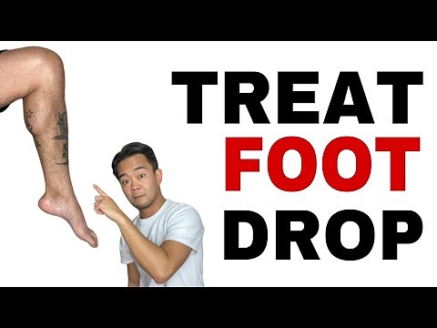 How to Treat Drop Foot | Foot Drop