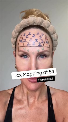 Tox mapping at 54 ❤️ Every face has unique needs. This dosing has been working perfectly for my very strong frontalis muscle. Learn more in my free safety focused educational videos at Rumble.com/GorgeouslyAging #antiaging #skincare #antiagingtreatment #facialrejuvenation | Gorgeously Aging
