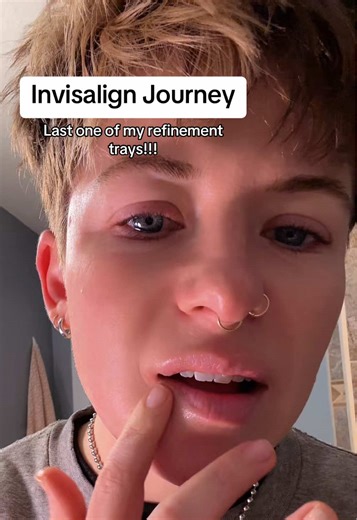 Dance Break in the Bathroom: Invisalign Journey