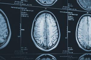 8 Unsolved Medical Mysteries That Still Stump Doctors