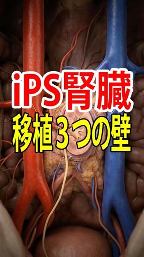 [Kidney Regeneration] What are the "three hurdles" to transplanting a kidney created with iPS cel...