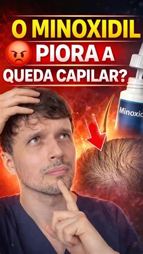 MINOXIDIL PIORA A QUEDA DE CABELO?