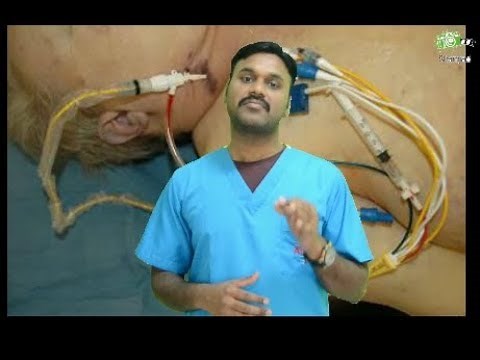 MIXED VENOUS BLOOD GAS