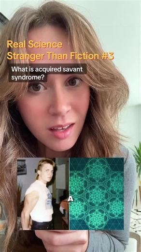 After a traumatic brain injury, @Jason Padgett began seeing the world as geometric patterns and mathematical structures. Scientists call this Acquired Savant Syndrome. It’s a rare condition where extraordinary abilities appear after brain trauma. Cases like this make researchers wonder whether hidden abilities already exist in the human brain. Part of my Real Science Stranger Than Fiction series exploring the mysteries of the mind. #JasonPadgett #AcquiredSavantSyndrome #BrainScience #Neuroscienc