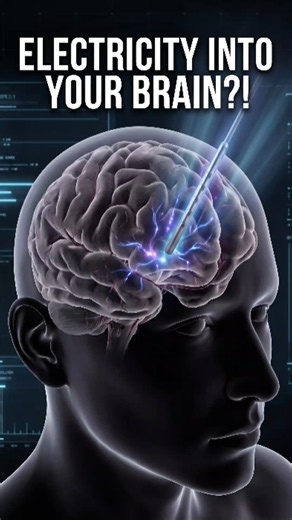 How Deep Brain Stimulation Actually Works 🧠⚡ #DeepBrainStimulation #DBS
