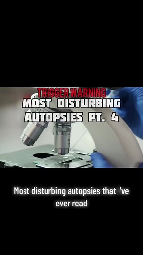 Disturbing Autopsies- Wood Chipper Accident #worstdeaths #freakaccident #autopsy #morbidscience #woodchipper