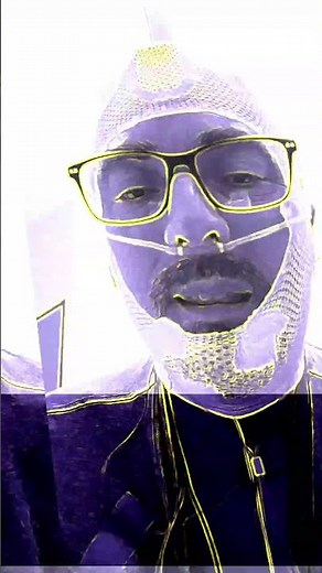 Sleep apnea: my story...