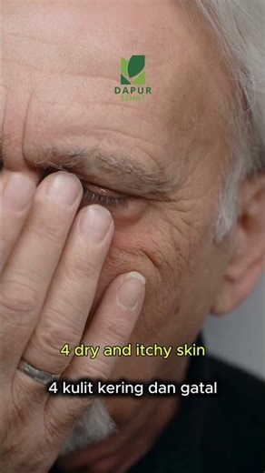 6 Signs Your Kidneys Are Starting to Have Problems!