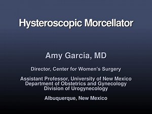 Hysteroscopic Morcellator - SlideServe