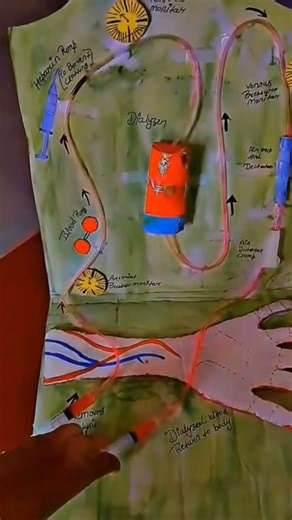beautiful working model of human dialysis✍️👩‍🔬
