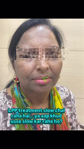 LPP Treatment Slow? These Mistakes Can Cause Relapse | Real Patient Story #drashimagoel