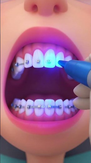 Dentist - Task 3: Perform the procedure