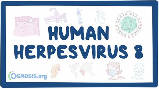 Human herpesvirus 8 (Kaposi sarcoma): Video, Causes, & Meaning | Osmosis
