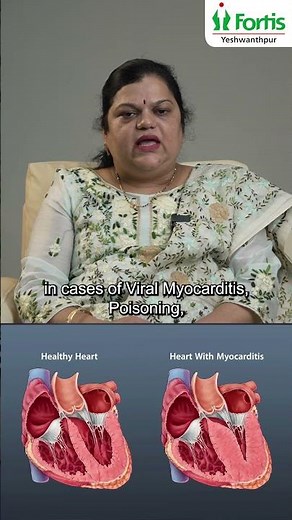 Extracorporeal Membrane Oxygenation | Dr. Chaitra Rao | Fortis Hospital, Yeshwanthpur, Bengaluru
