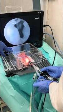 incontinence that is so easy and effective Bulkamid stressincontinence postpartum bulkamid