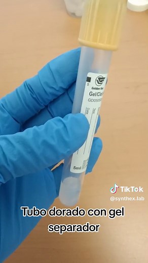 ¿Para qué sirven los diferentes tubos de muestra?