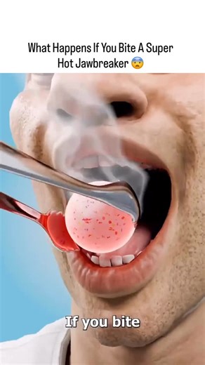 @funnyrrel on Instagram: "The post’s animated video depicts a jawbreaker exploding when bitten after heating, showing molten sugar spraying and burning the biter and bystanders, highlighting pressure buildup from boiling interior layers. - It draws from 2003 real-life cases, including 9-year-old Taquandra Diggs suffering severe facial burns from a Wonka Gobstopper explosion, prompting Nestlé’s out-of-court settlements with affected families. - MythBusters’ 2004 episode replicated this via microw