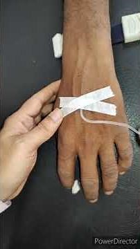 How to insert scalp vein set to give iv fluids to the patient #procedures #medicalprocedures