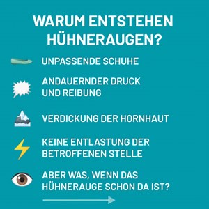 Warum genau entstehen eigentlich Hühneraugen? Das verraten wir euch heute. Denn wer weiß, wie sie entstehen, weiß nicht nur, wie er sie loswerden, sondern ihnen auch vorbeugen kann. 🙌🏼 Sind Hühneraugen bereits entstanden, helfen euch die Compeed® Hühneraugenpflaster! Wusstet ihr bereits, warum Hühneraugen entstehen und leidet vielleicht sogar selbst unter ihnen? 😲 #compeed #lippenherpes #unddertagistgerettet #keinechancefürherpes #herpes #herpesneindanke | Compeed