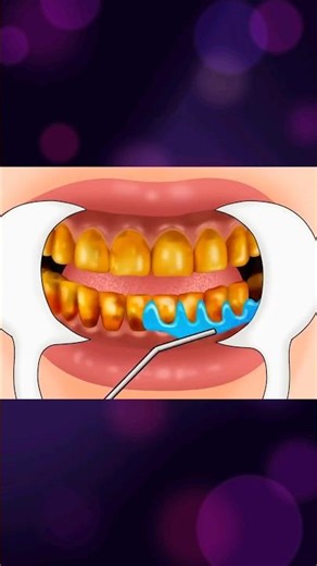 ASMR Teeth Cleaning Animation 🦷 | Satisfying Dental Cleaning | Deep Plaque Removal#asmranimation