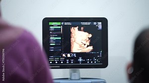 Doctor operating 4D Ultrasonography (USG) tools for pregnant woman