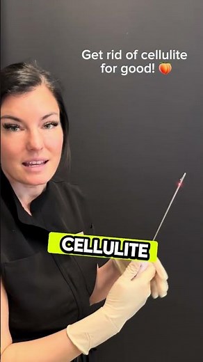 Aveli: Cellulite Reduction