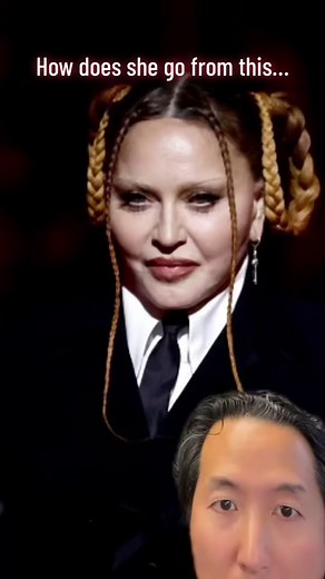 Madonna’s transformation explained! I’m not her doctor but this is what I think! #madonna #madonnafans #plasticsurg