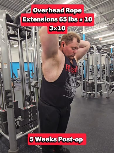 Week 20: Push Day Exercise 6: Overhead Rope Extensions 5 Weeks Post-op 65 lbs × 10 3×10 #pushday#exercise#workout