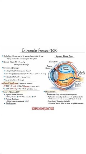 INTRAOCCULAR PRESSURE (IOP) 👁️#aqoushumor #iop #quickstudy #intraocularpressure #intraocularlens