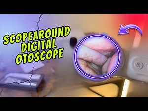 Cleaning Your Ears with an Scopearound Digital Otoscope Review 🔥