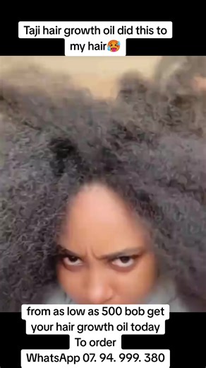 extreme hair growth #hairgrowthtips #kenyantiktok🇰🇪 #howtogrowhair #hairtok #nairobitiktokers