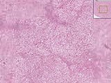 Fatty change - Histopathology - Liver • Video • MEDtube.net