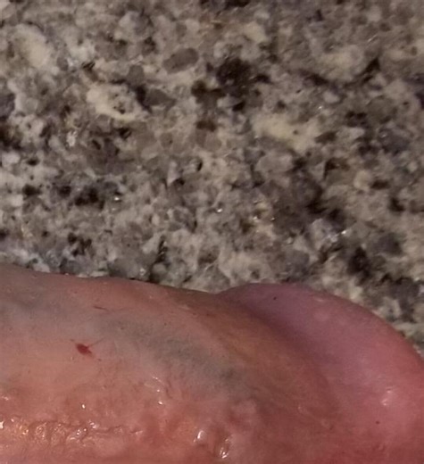 Mature 8.5" STP FTM Packer Prosthetic Penis Trans - Etsy