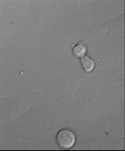 Radiobiology Lecture #3