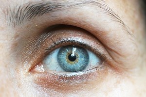 How To Get Rid of Hooded Eyes Naturally | Skincare Lab