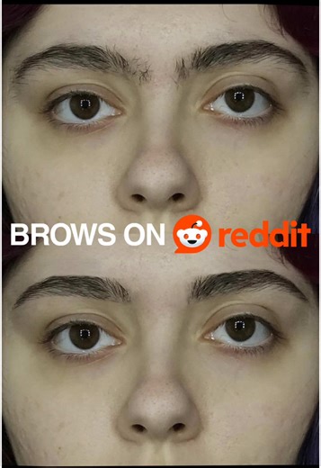 How to Fix Asymmetrical Eyebrows: A Detailed Tutorial