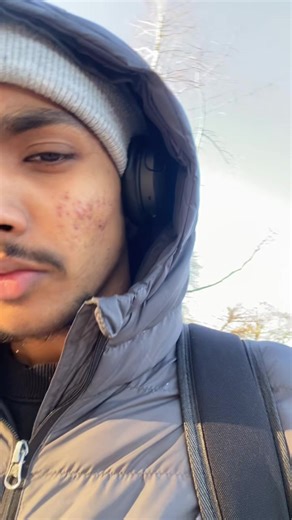 Embrace Beanie Season: Style Tips and Trends