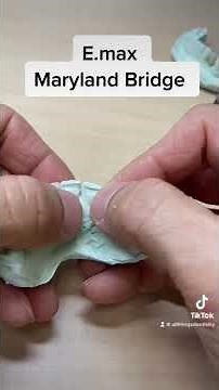 Front Tooth Replacement #dentistry