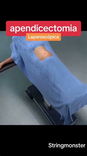 Stringmonster no TikTok