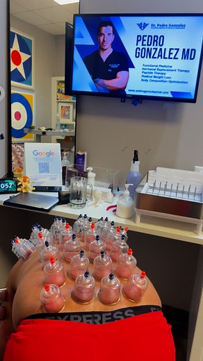 18K views · 49 reactions |  Cupping Therapy for Recovery...