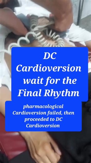 When to do synchronised Cardioversion? Indications? What rhythm is it? Comment down? #cardiology #EKG #ECG #paramedic #nursing #EMS #medicine #medstudent #cardiologia #fblifestyle | The Stubborn Dr
