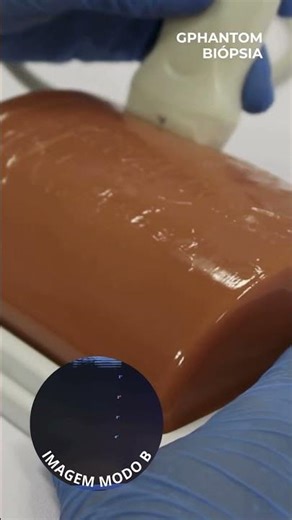 Gphantom Biopsy - Ultrasound guided procedure